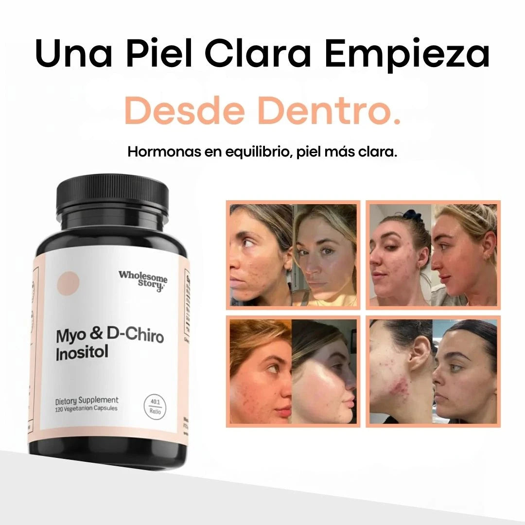 Myo & D-Chiro Inositol – Suplemento para Acné Hormonal